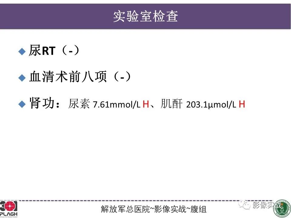 影像PPT - 【病例】右肾透明细胞肾癌1例MR影像-3