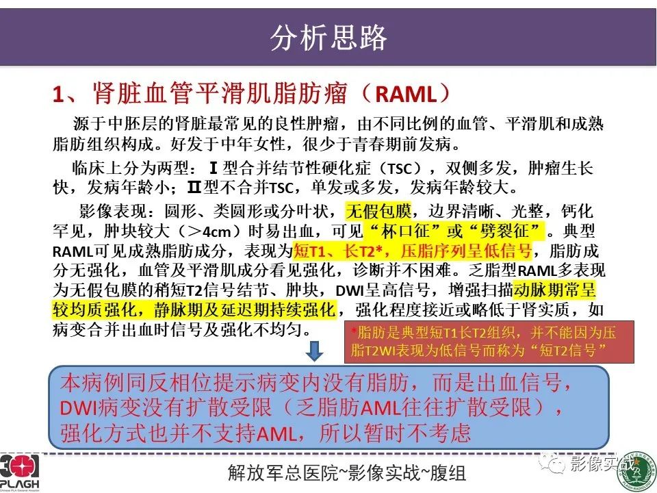 影像PPT - 【病例】右肾透明细胞肾癌1例MR影像-14