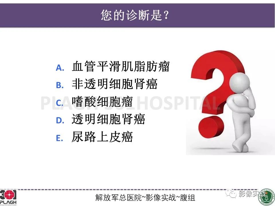 影像PPT - 【病例】右肾透明细胞肾癌1例MR影像-4