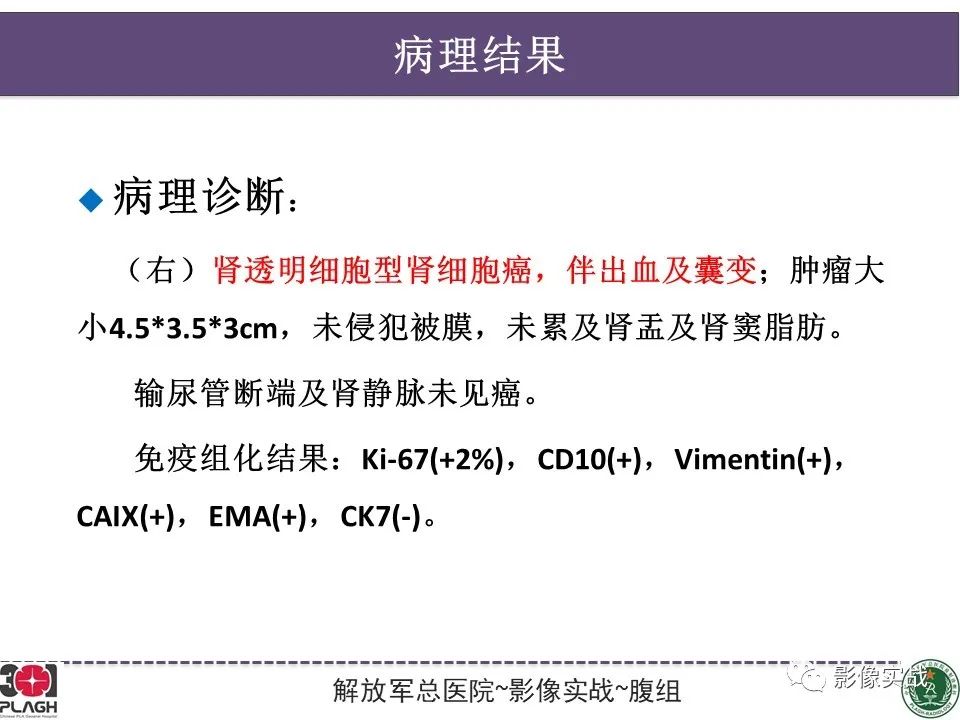 影像PPT - 【病例】右肾透明细胞肾癌1例MR影像-8