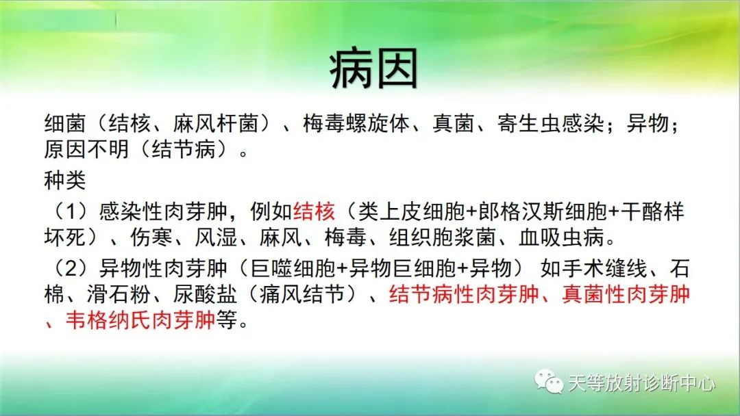 影像PPT - 【PPT】肺结核肉芽肿性影像学诊断与鉴别诊断-3 影像PPT - 【PPT】肺结核肉芽肿性影像学诊断与鉴别诊断-3