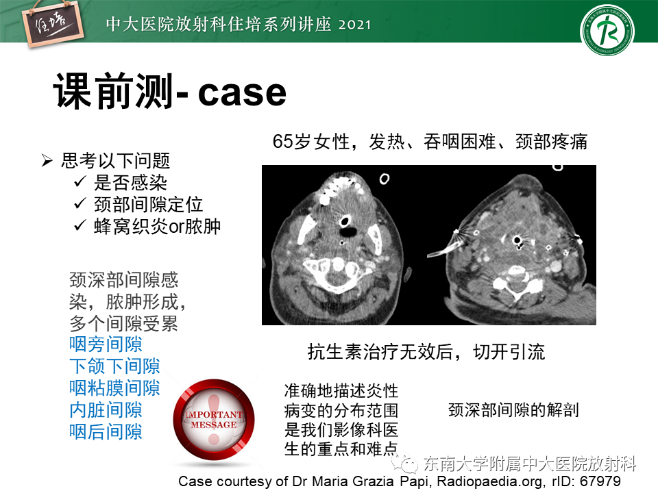 影像PPT - 【PPT】颈部感染的影像诊断及蔓延途径-2
