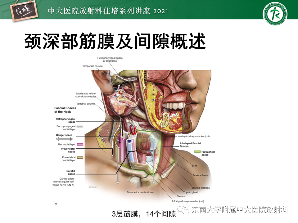 影像PPT - 【PPT】颈部感染的影像诊断及蔓延途径-9