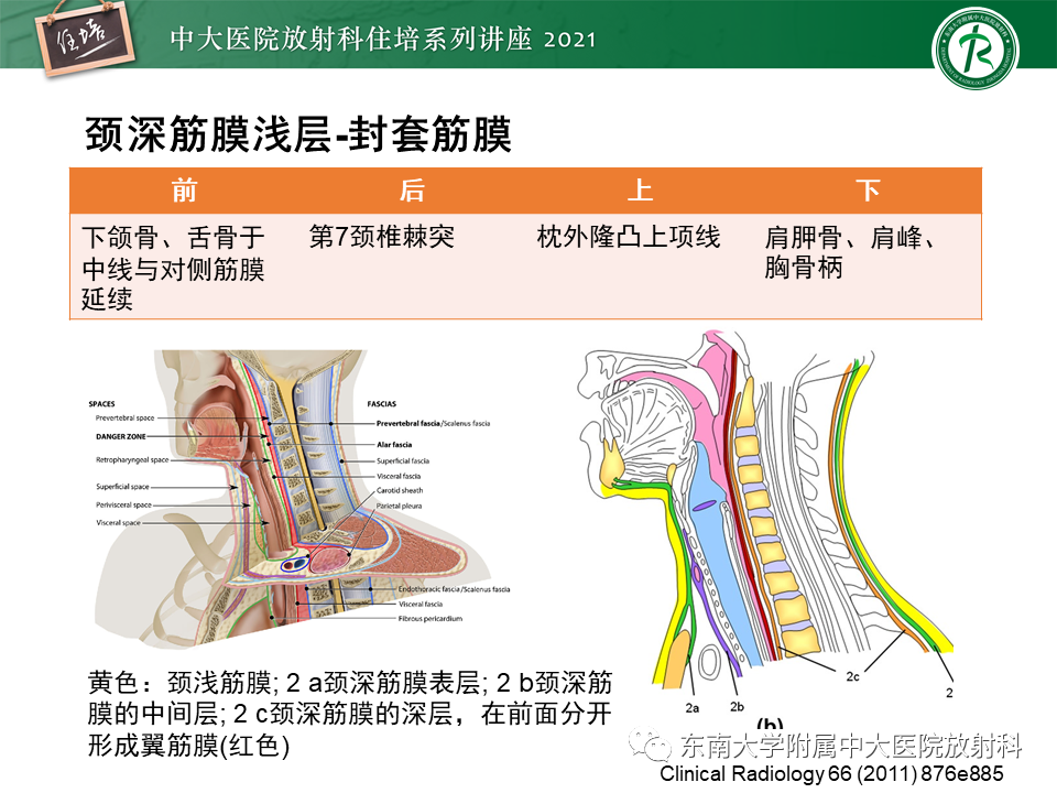 影像PPT - 【PPT】颈部感染的影像诊断及蔓延途径-12