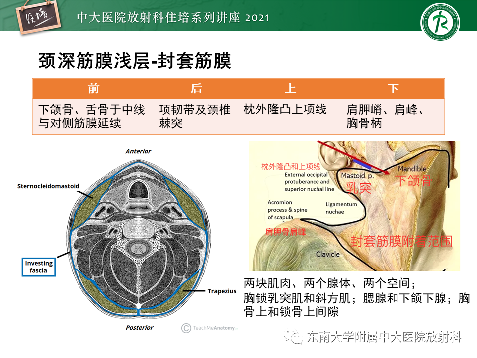 影像PPT - 【PPT】颈部感染的影像诊断及蔓延途径-11