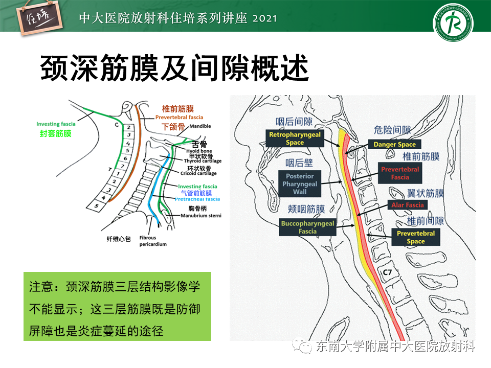 影像PPT - 【PPT】颈部感染的影像诊断及蔓延途径-10