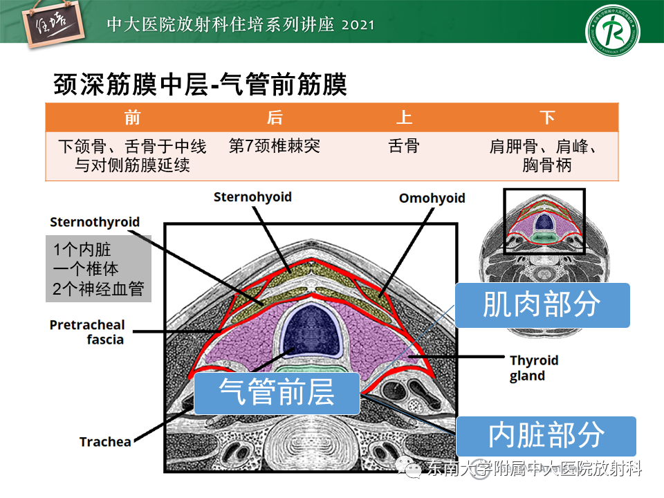 影像PPT - 【PPT】颈部感染的影像诊断及蔓延途径-14