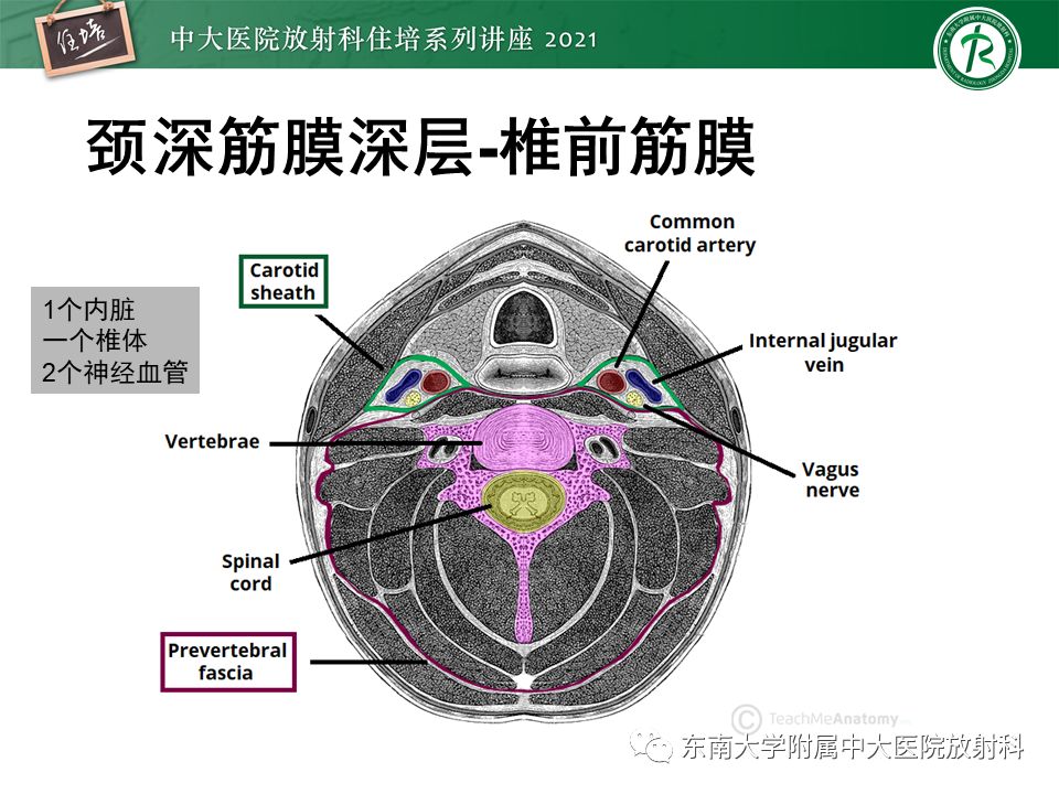 影像PPT - 【PPT】颈部感染的影像诊断及蔓延途径-15