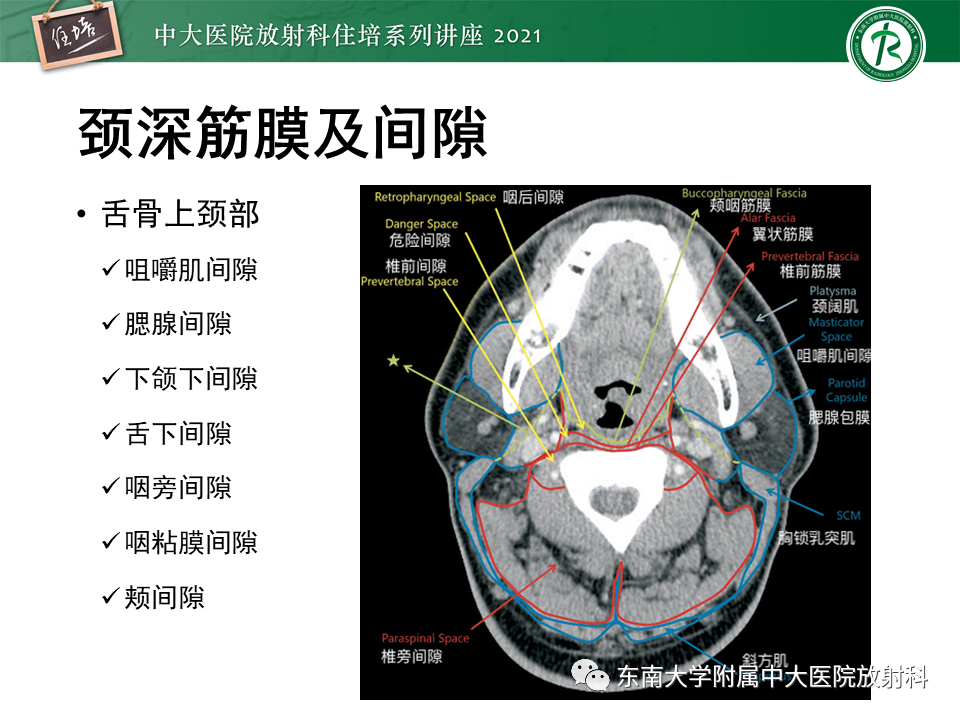 影像PPT - 【PPT】颈部感染的影像诊断及蔓延途径-21