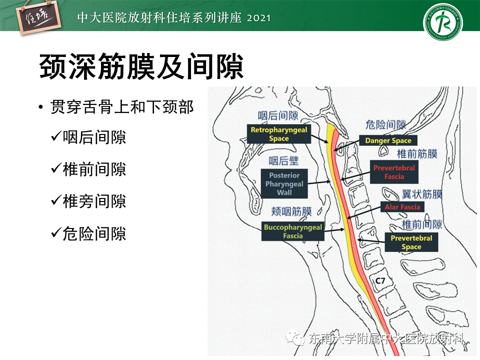 影像PPT - 【PPT】颈部感染的影像诊断及蔓延途径-22