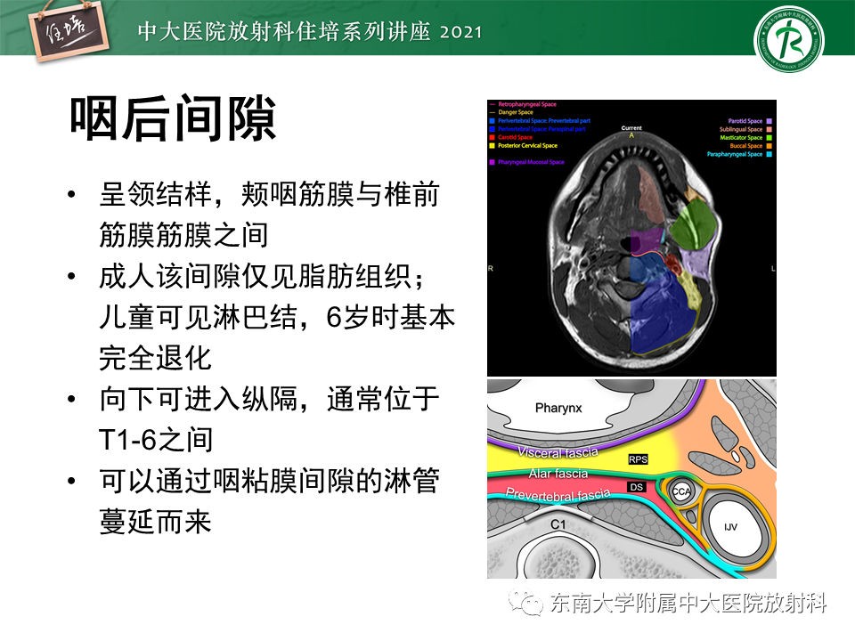 影像PPT - 【PPT】颈部感染的影像诊断及蔓延途径-24