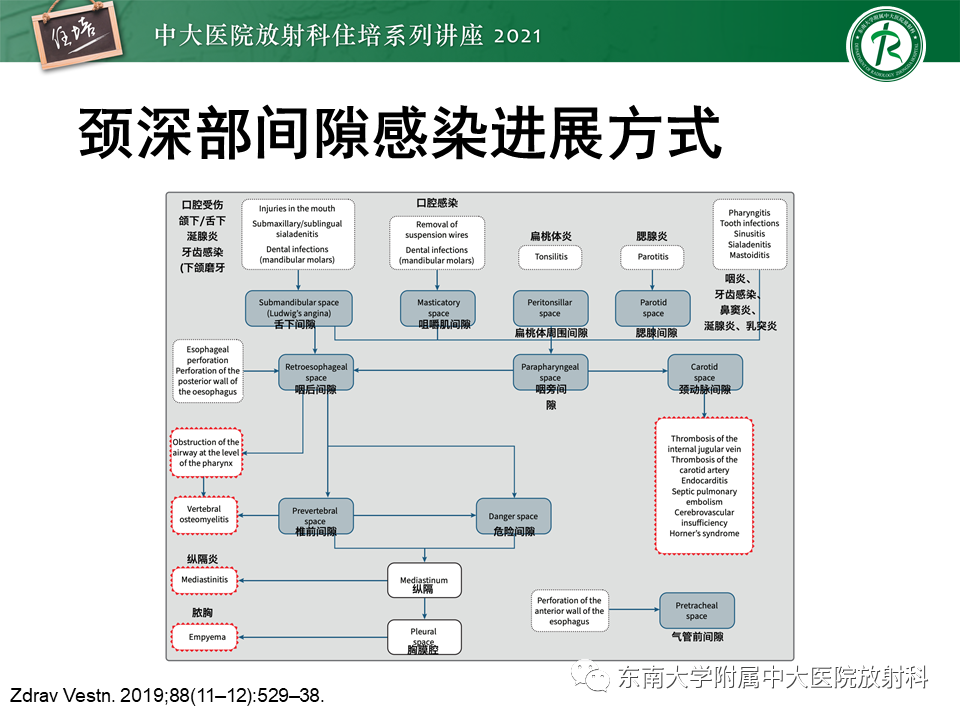 影像PPT - 【PPT】颈部感染的影像诊断及蔓延途径-27