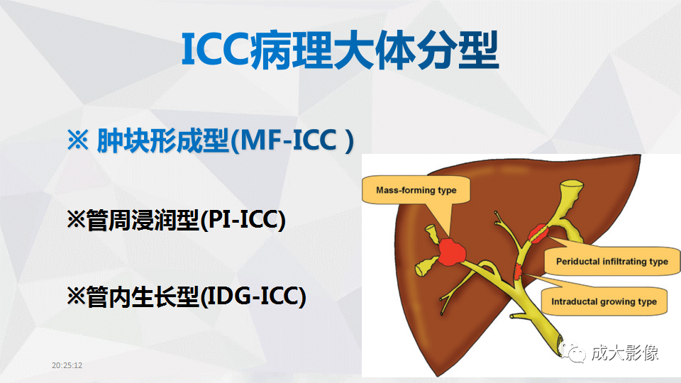 影像PPT - 【PPT】肿块型肝内胆管细胞癌影像学-4