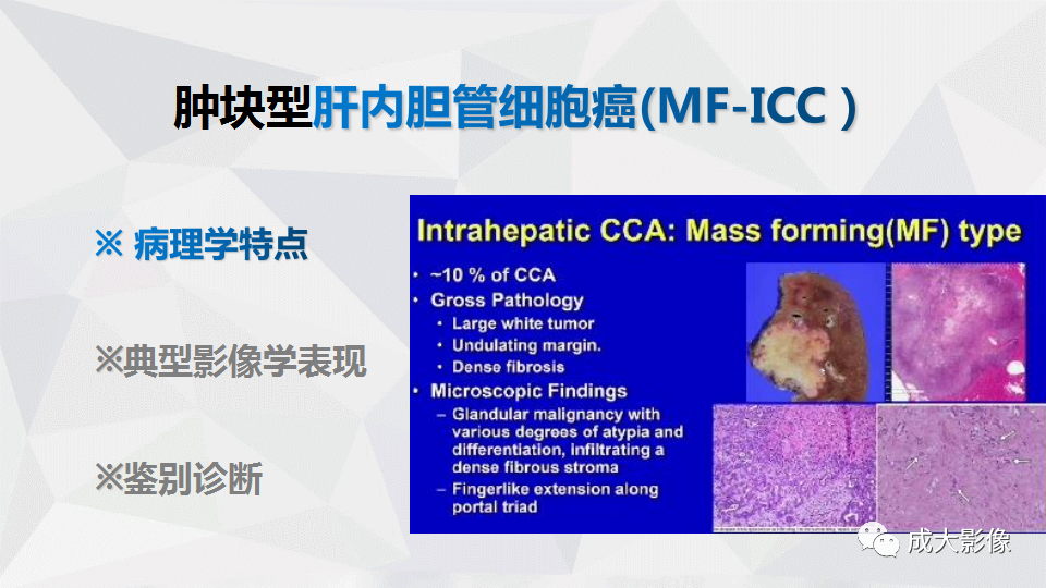 影像PPT - 【PPT】肿块型肝内胆管细胞癌影像学-5