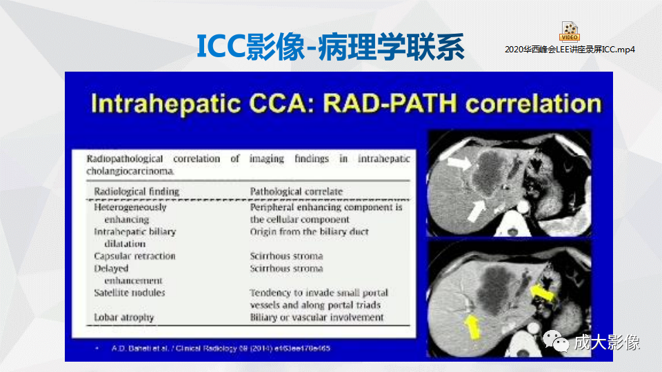 影像PPT - 【PPT】肿块型肝内胆管细胞癌影像学-6
