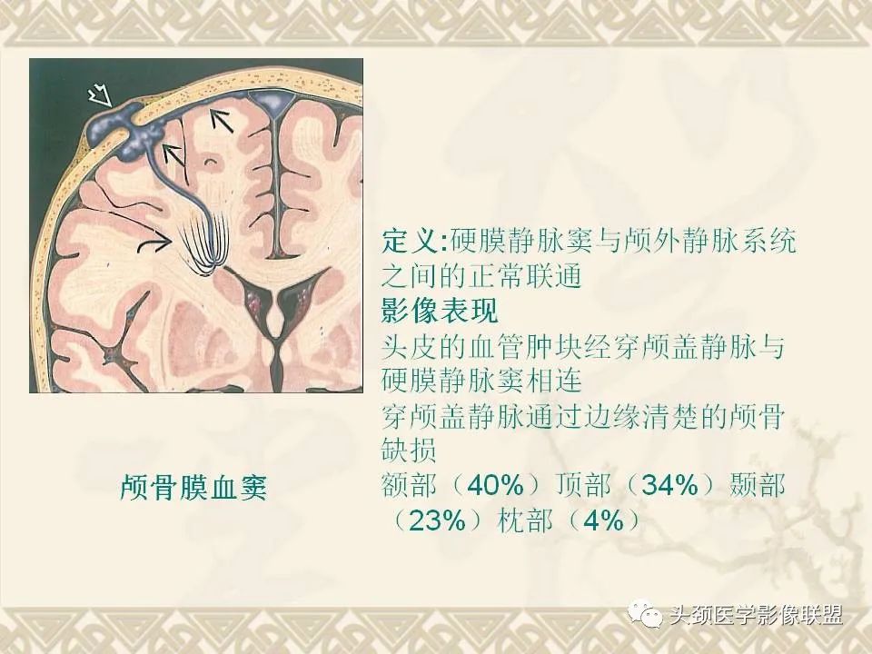 影像PPT - 【PPT】颅骨肿瘤的影像学诊断与鉴别诊断-9