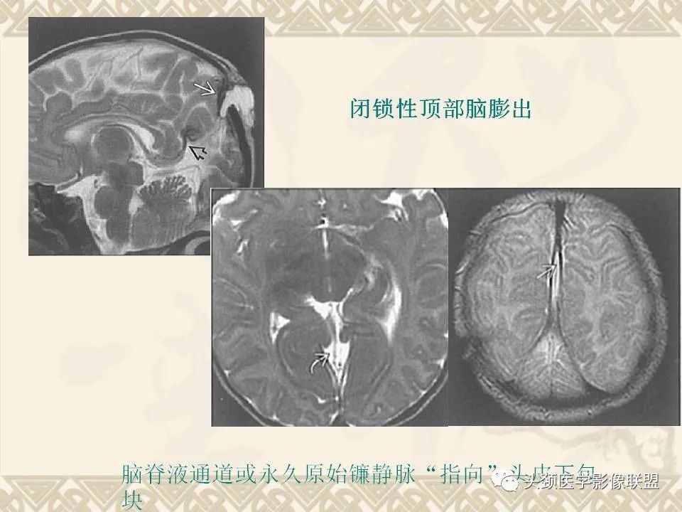 影像PPT - 【PPT】颅骨肿瘤的影像学诊断与鉴别诊断-15