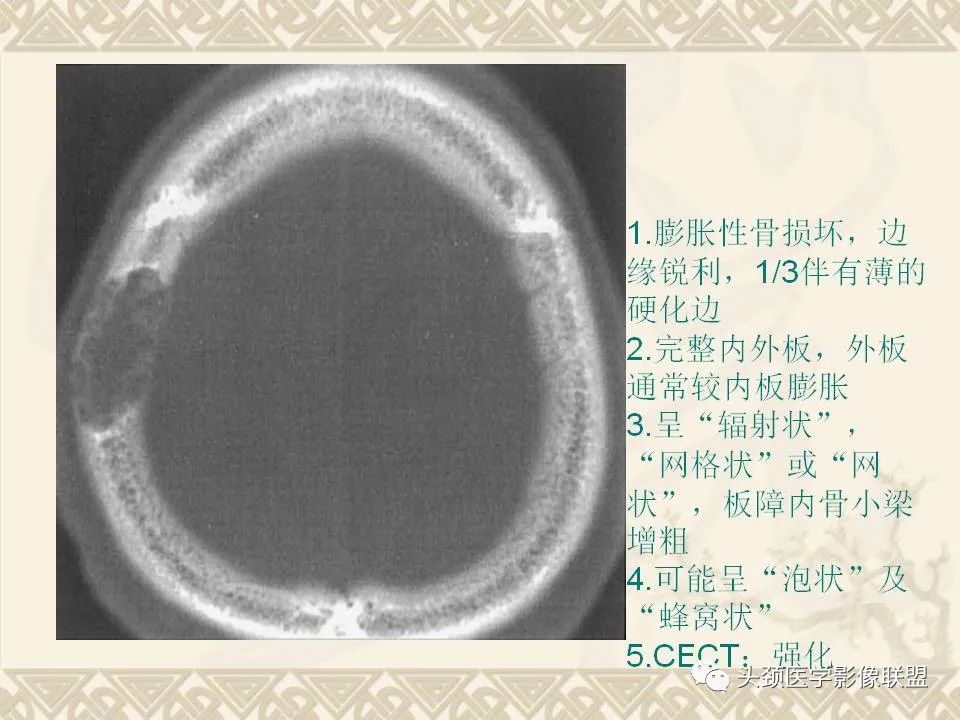 影像PPT - 【PPT】颅骨肿瘤的影像学诊断与鉴别诊断-21