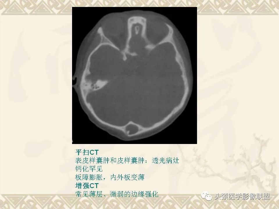 影像PPT - 【PPT】颅骨肿瘤的影像学诊断与鉴别诊断-27
