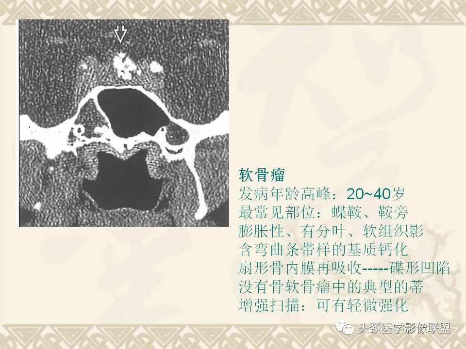 影像PPT - 【PPT】颅骨肿瘤的影像学诊断与鉴别诊断-92