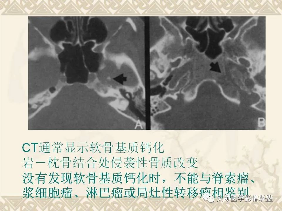 影像PPT - 【PPT】颅骨肿瘤的影像学诊断与鉴别诊断-94