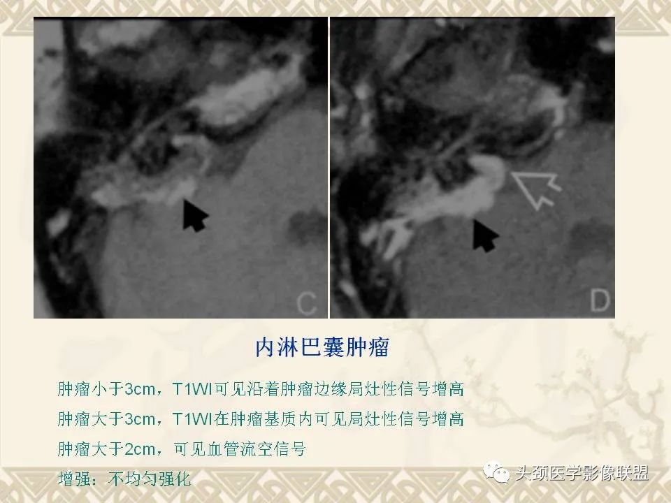 影像PPT - 【PPT】颅骨肿瘤的影像学诊断与鉴别诊断-117