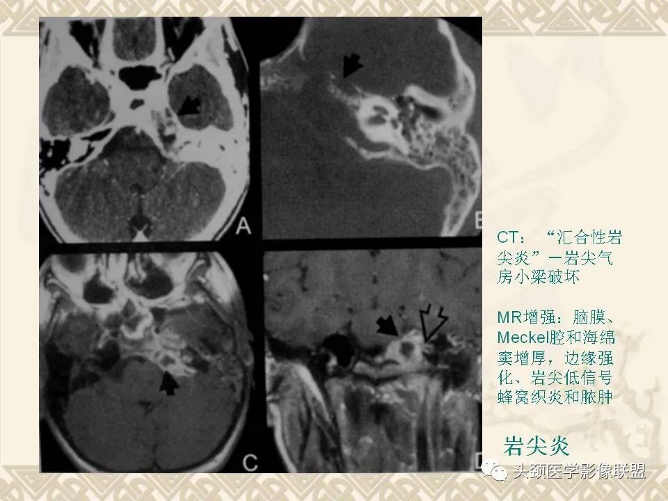 影像PPT - 【PPT】颅骨肿瘤的影像学诊断与鉴别诊断-129