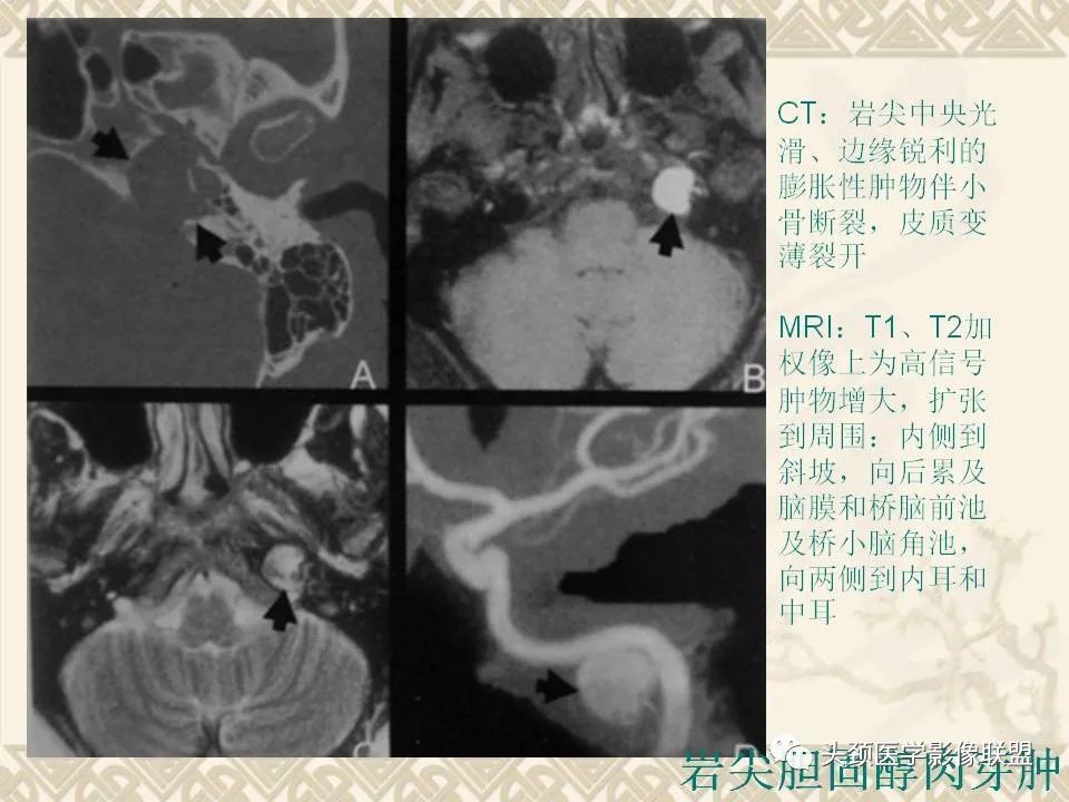 影像PPT - 【PPT】颅骨肿瘤的影像学诊断与鉴别诊断-131