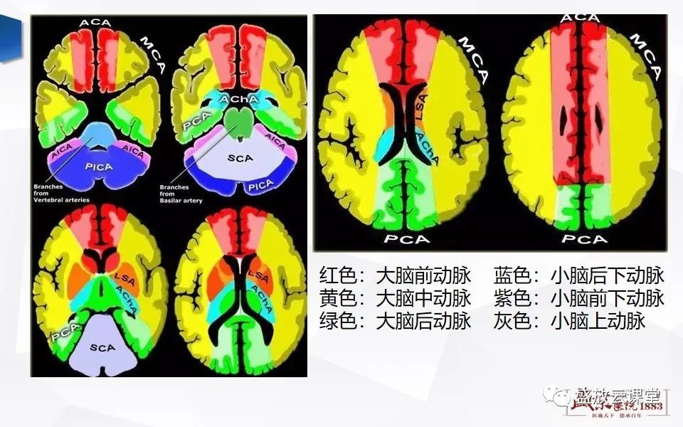 影像PPT - 【PPT】DWI在脑卒中诊断中的作用-9