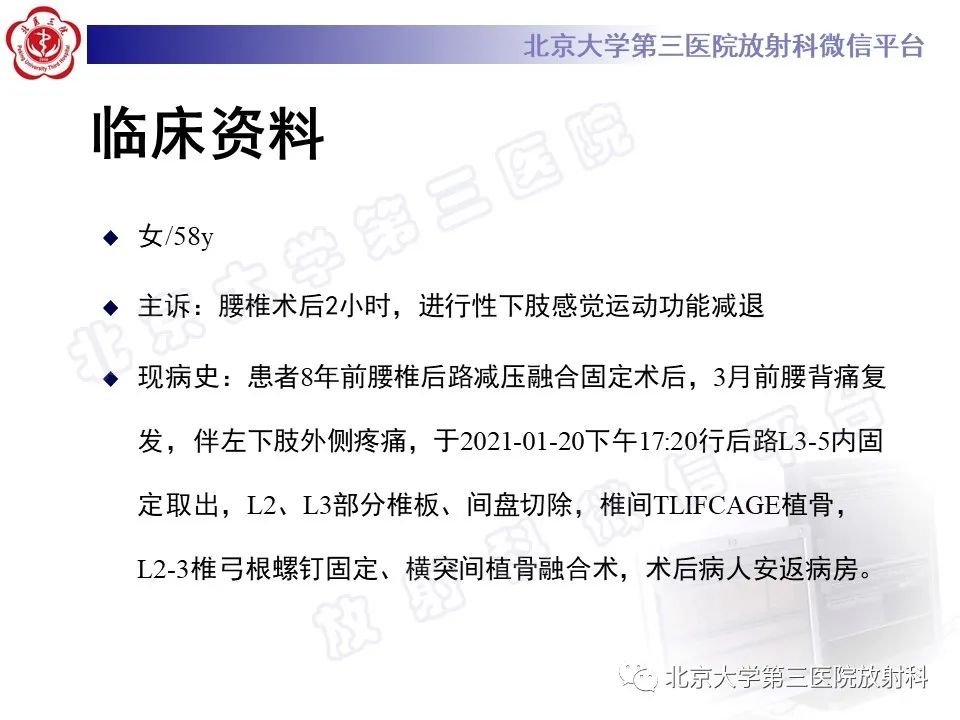影像PPT - 【PPT】脊柱术后硬膜外血肿-2