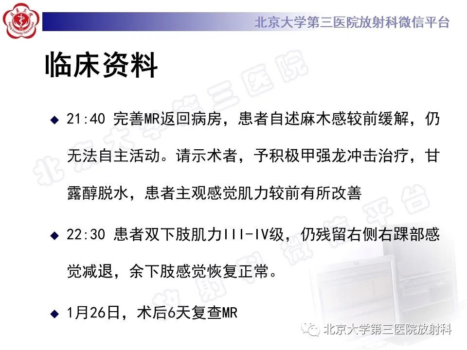 影像PPT - 【PPT】脊柱术后硬膜外血肿-5