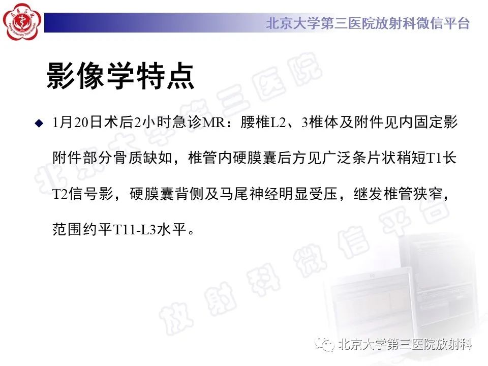 影像PPT - 【PPT】脊柱术后硬膜外血肿-7
