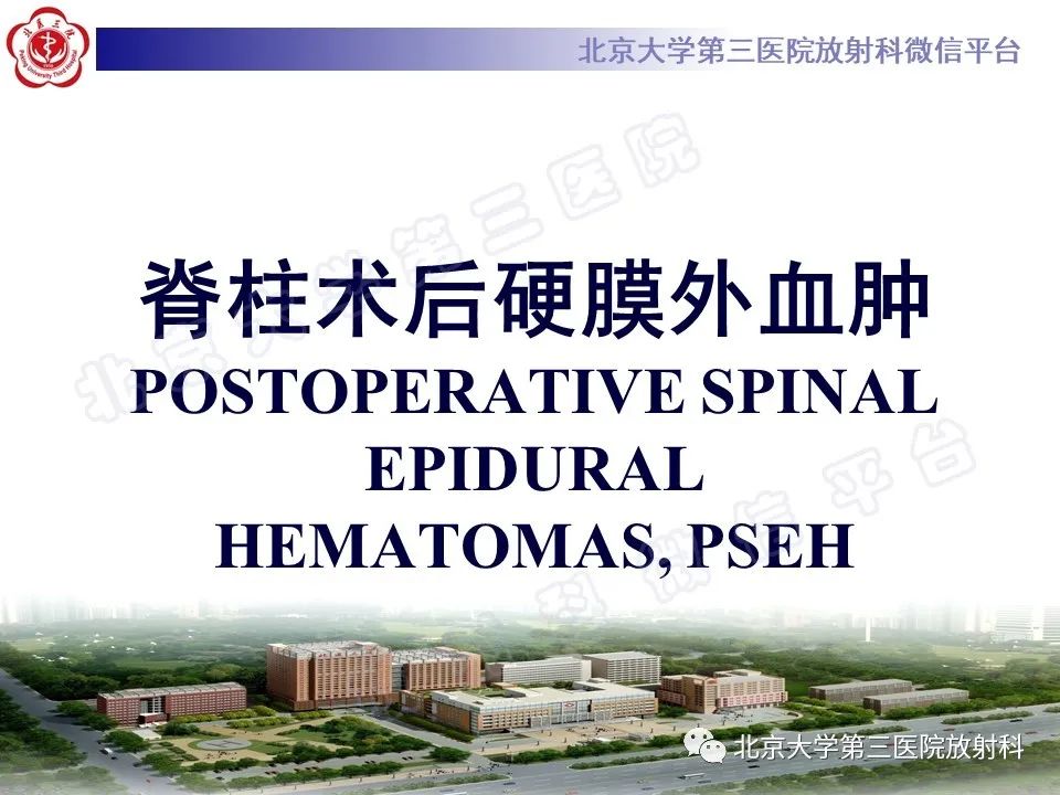 影像PPT - 【PPT】脊柱术后硬膜外血肿-9