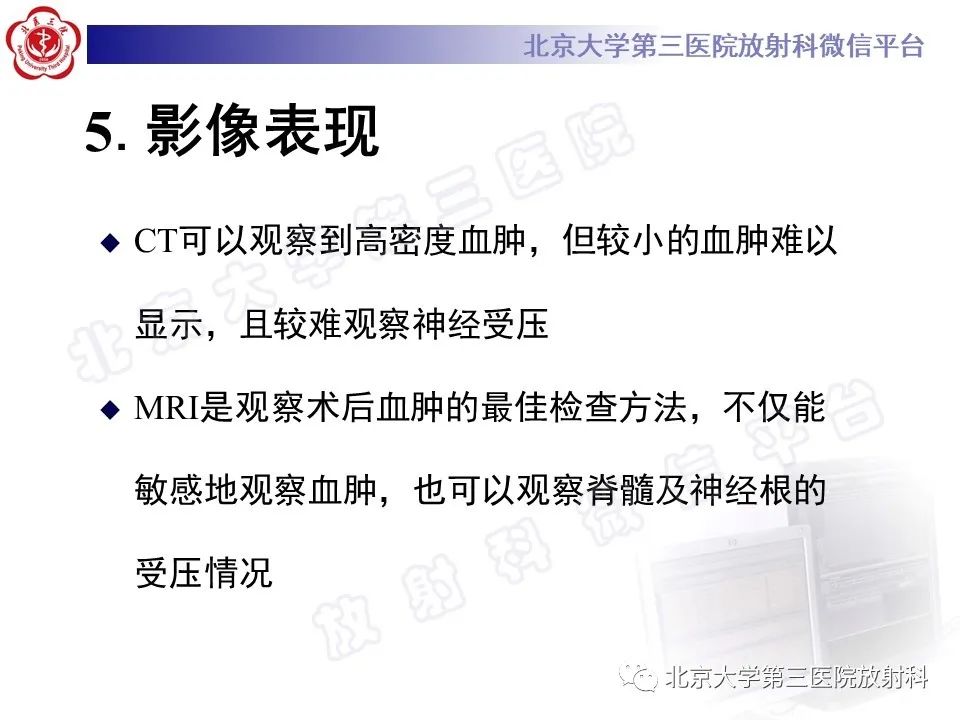 影像PPT - 【PPT】脊柱术后硬膜外血肿-15