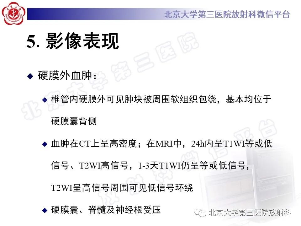 影像PPT - 【PPT】脊柱术后硬膜外血肿-16