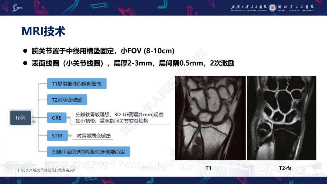 影像PPT - 【PPT】腕关节疼痛MRI评估-4