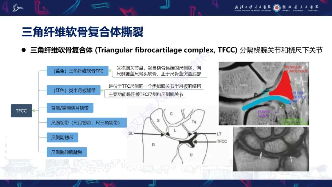 影像PPT - 【PPT】腕关节疼痛MRI评估-5