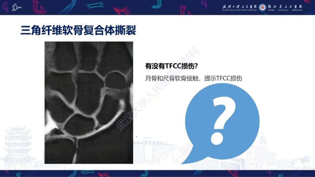 影像PPT - 【PPT】腕关节疼痛MRI评估-8