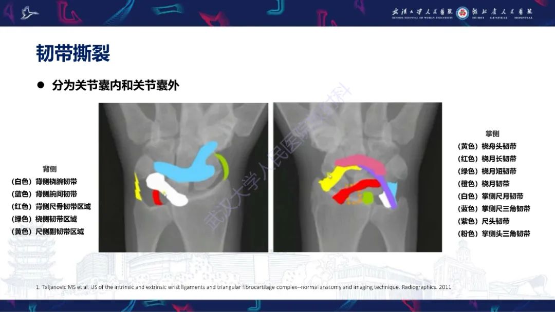 影像PPT - 【PPT】腕关节疼痛MRI评估-10