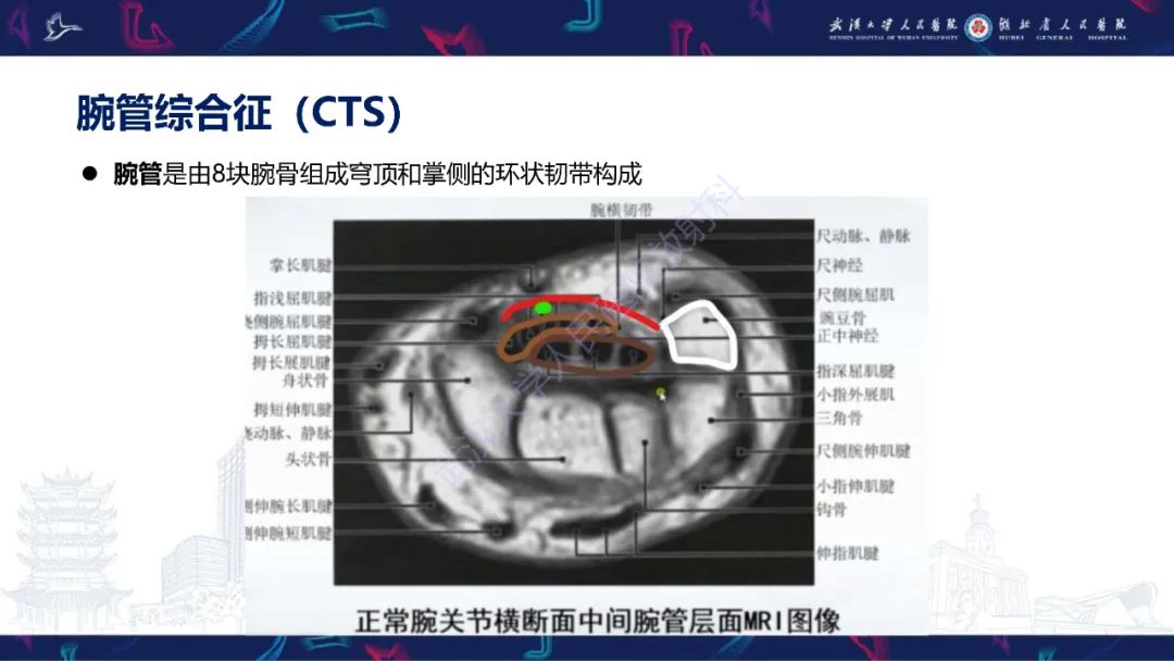 影像PPT - 【PPT】腕关节疼痛MRI评估-16