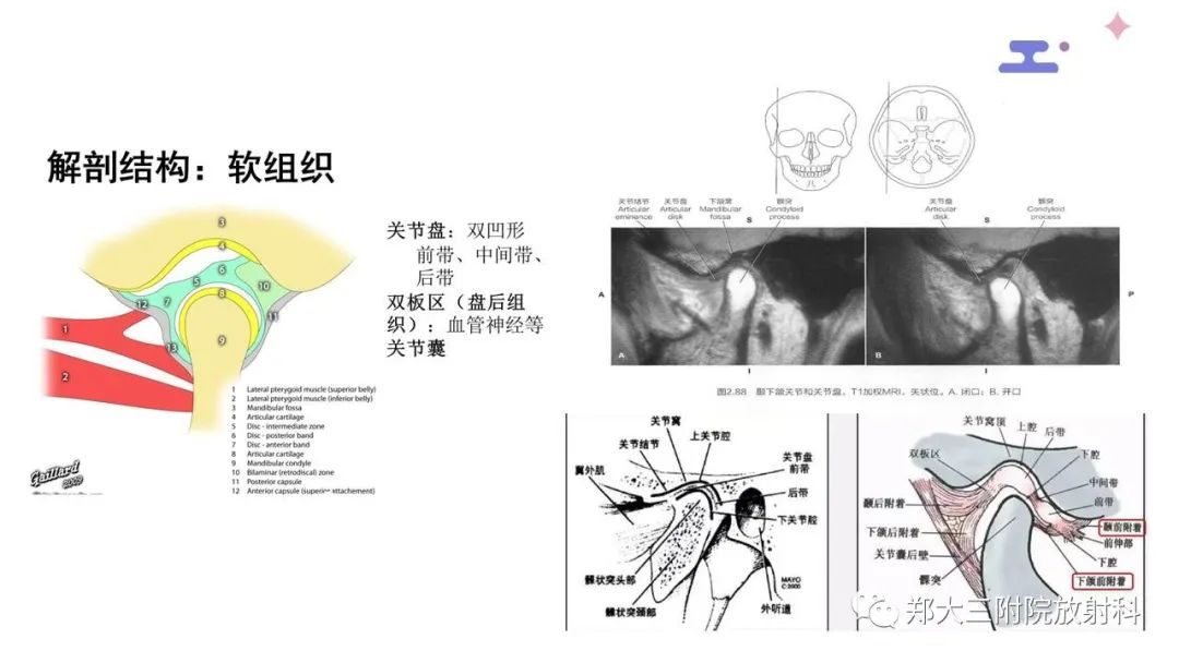 影像PPT - 【PPT】颞下颌关节紊乱的影像学表现-6