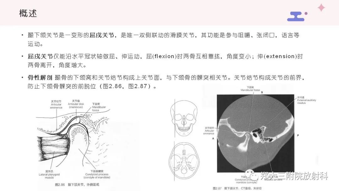 影像PPT - 【PPT】颞下颌关节紊乱的影像学表现-4