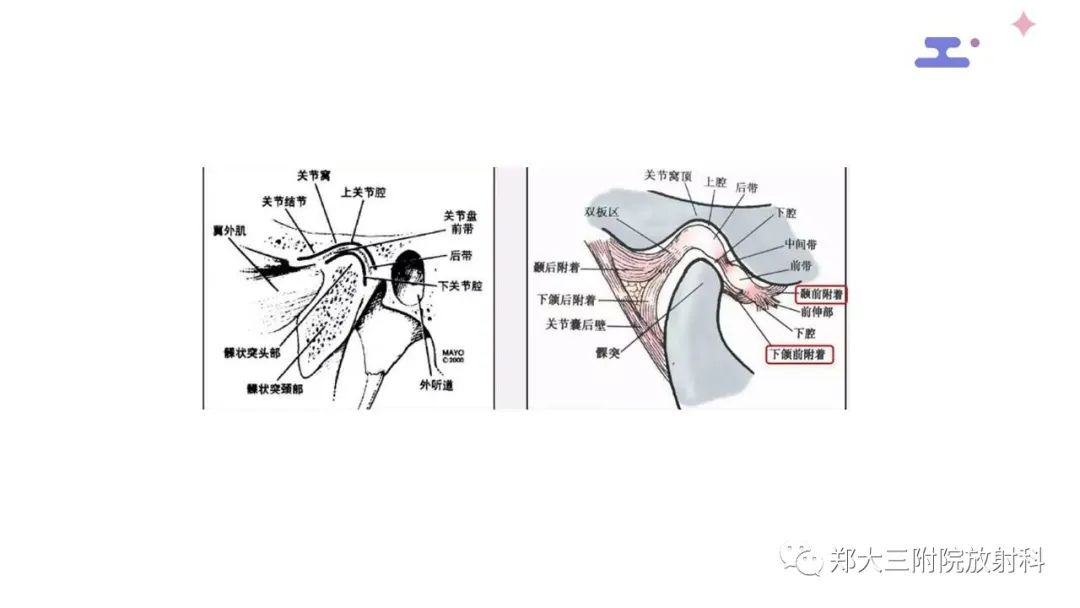影像PPT - 【PPT】颞下颌关节紊乱的影像学表现-9