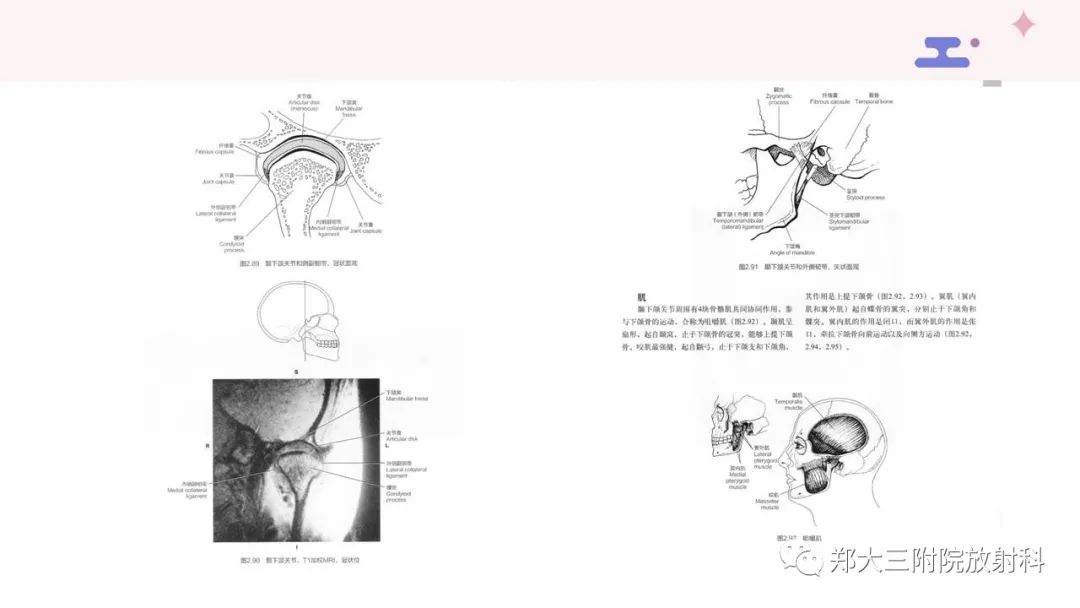 影像PPT - 【PPT】颞下颌关节紊乱的影像学表现-7