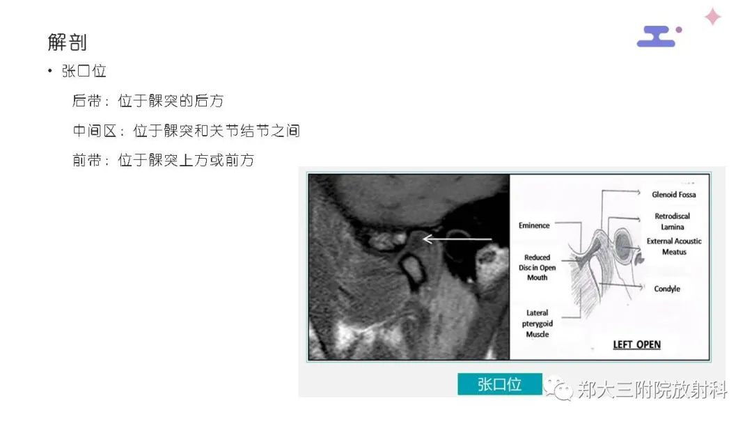 影像PPT - 【PPT】颞下颌关节紊乱的影像学表现-14
