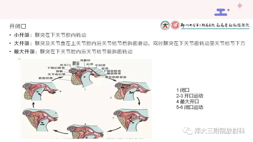 影像PPT - 【PPT】颞下颌关节紊乱的影像学表现-19