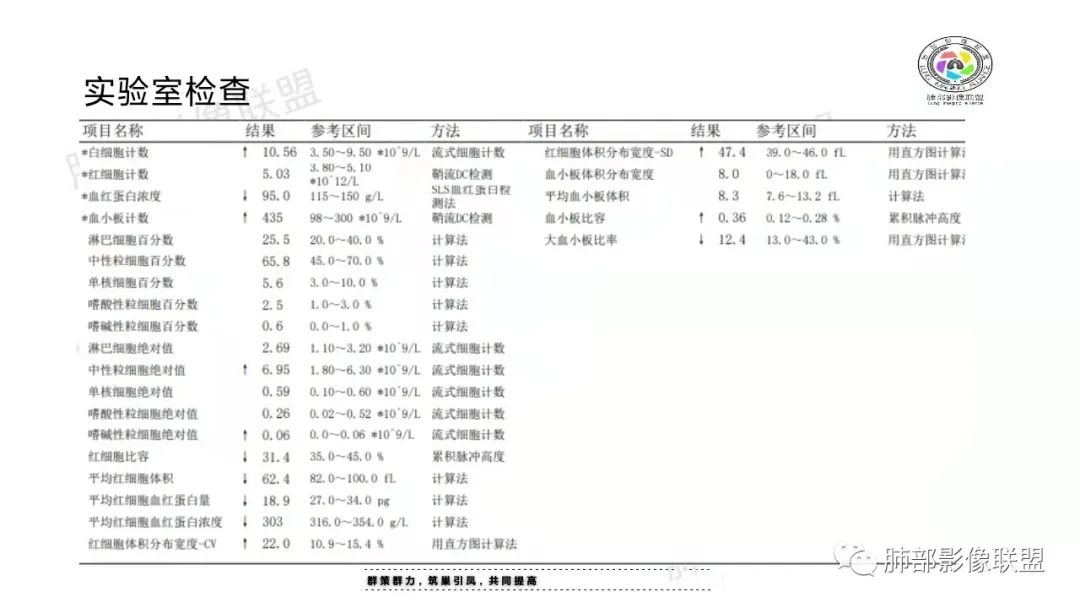 影像PPT - 【病例】纵隔成熟型囊性畸胎瘤1例CT-3 影像PPT - 【病例】纵隔成熟型囊性畸胎瘤1例CT-3