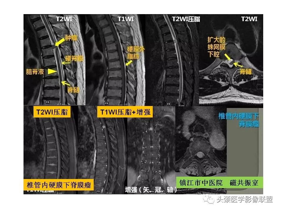 影像PPT - 【PPT】颅脑解剖及血管性病变的MRI诊断-19