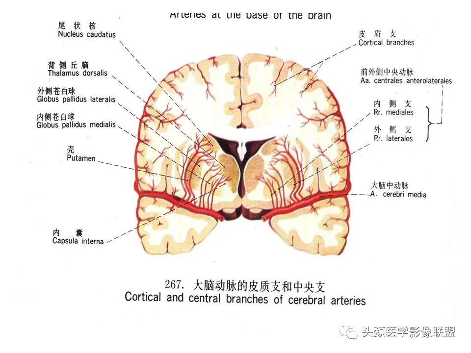 影像PPT - 【PPT】颅脑解剖及血管性病变的MRI诊断-86