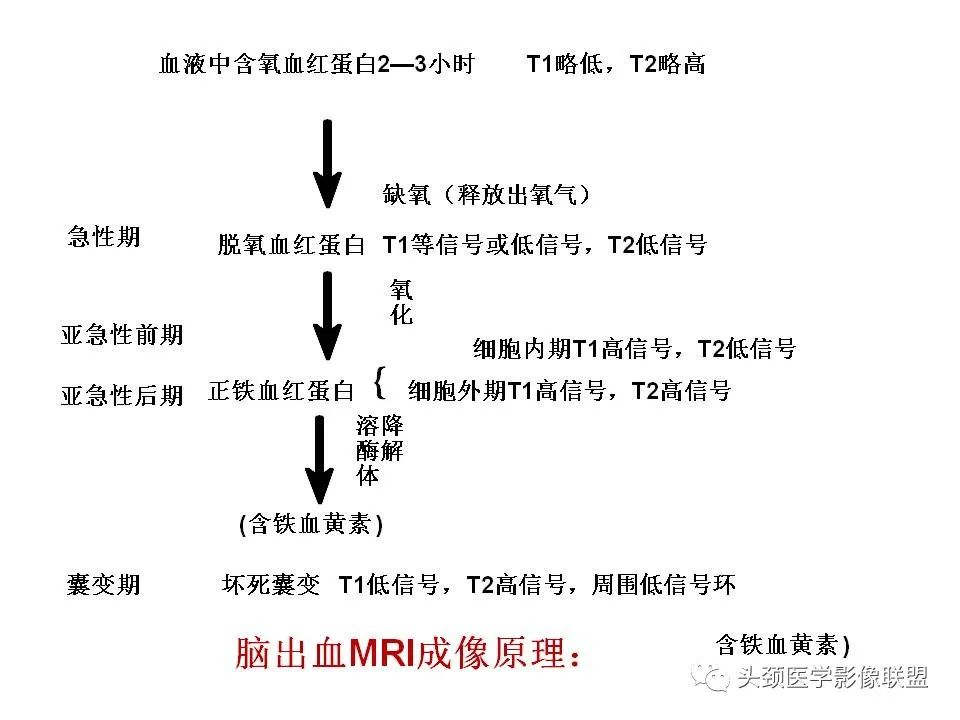 影像PPT - 【PPT】颅脑解剖及血管性病变的MRI诊断-121